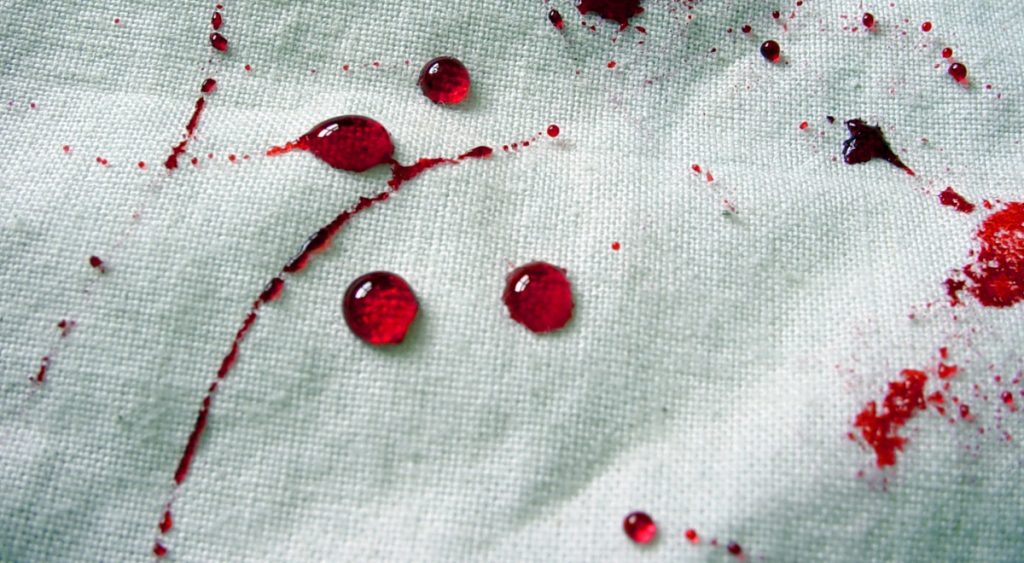 Bloodstain Pattern Analysis