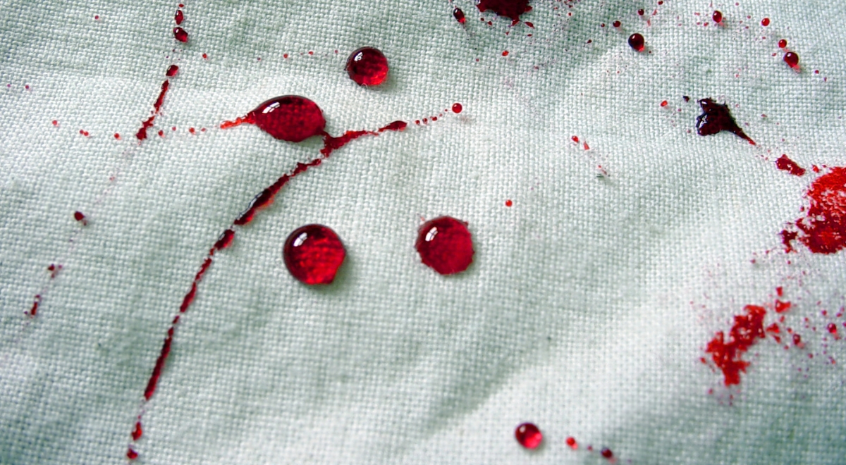 Bloodstain Pattern Analysis